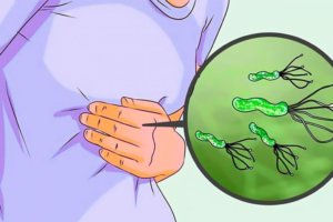 HELICOBÁCTER PYLORI «La bacteria relacionada con el cáncer de estómago»